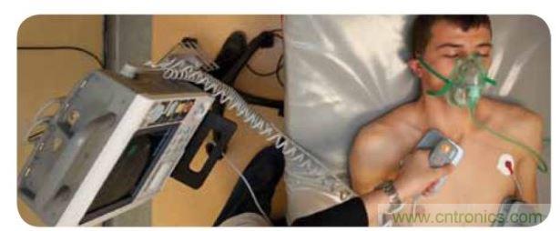 帶電極的醫(yī)院用除顫器。注意，患者身上有外部心電圖或心臟監(jiān)護儀，從胸部的白色圓片(電極)和導聯(線)可看出來。